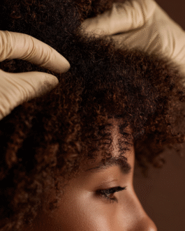 Diagnostic trichologique - Analyse experte du cuir chevelu et des cheveux texturés